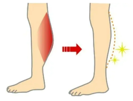 瘦小腿要對(duì)癥下藥