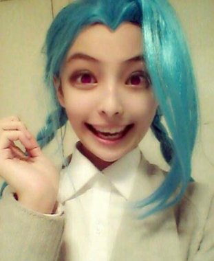 怎樣預防紅眼病 保護心靈的窗戶